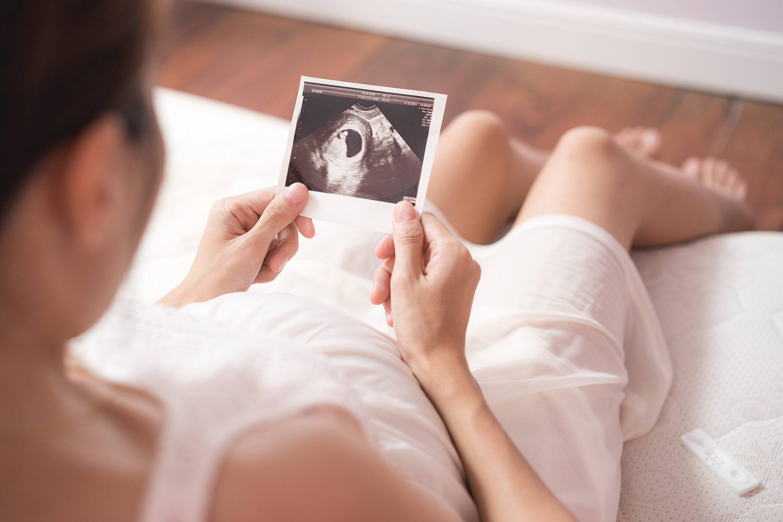 Pregnant asian woman looking at ultrasound scan of baby and touching her belly close up of scan | Navazon Digital